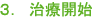 ３．治療開始