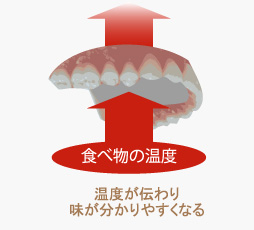 金属床義歯の写真