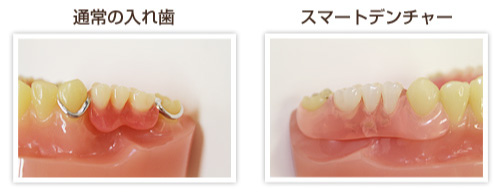 スマートデンチャーの写真